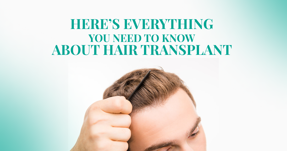 Here’s Everything You Need to Know about hair transplant