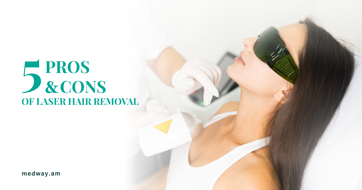 5 Pros and Cons of Laser Hair Removal