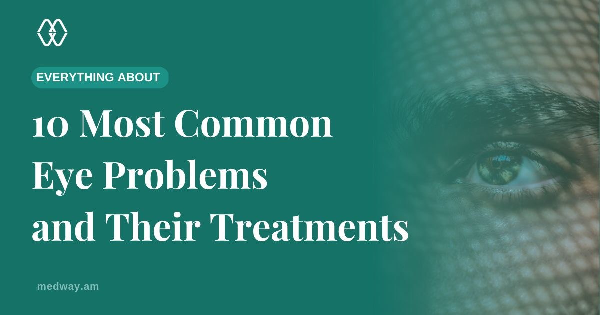 The 10 Most Common Eye Problems and Their Treatments