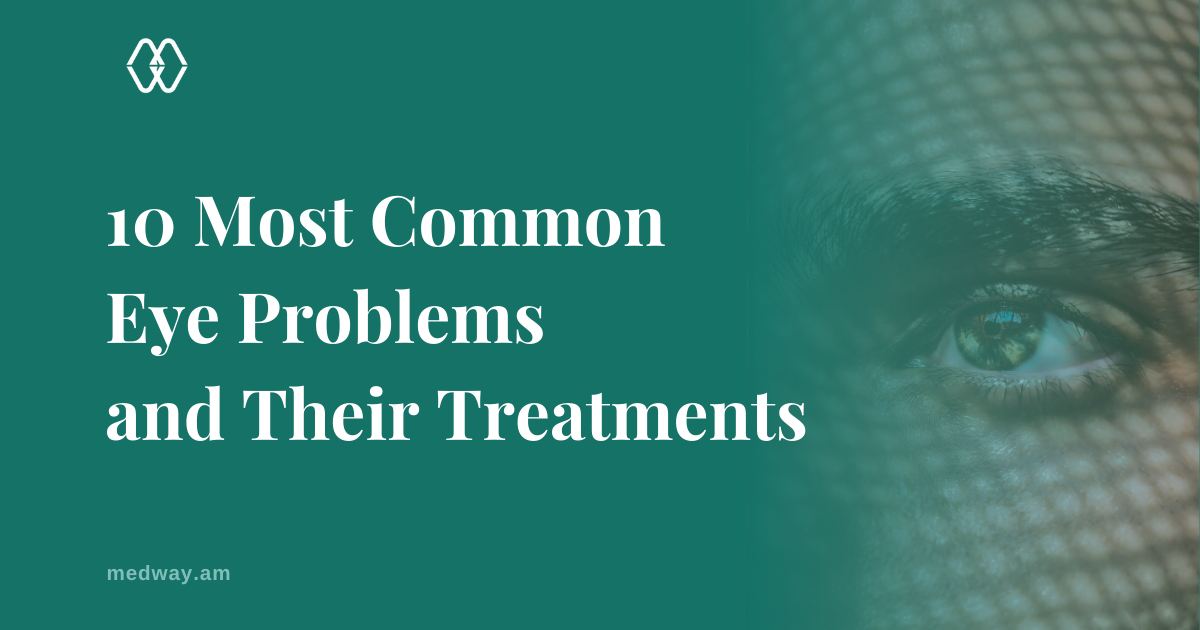 The 10 Most Common Eye Problems and Their Treatments