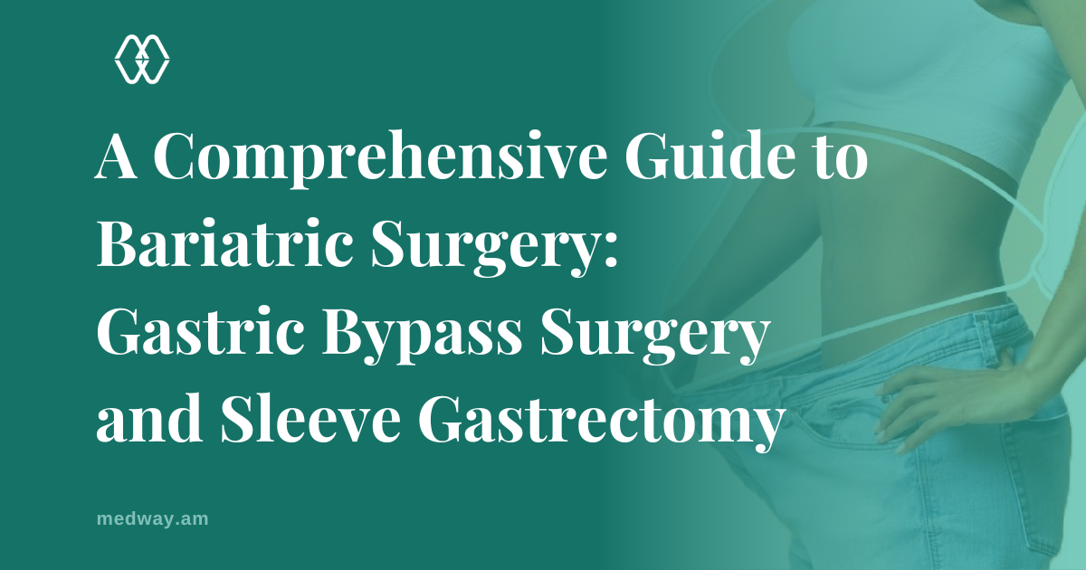 A Comprehensive Guide to Bariatric Surgery: Gastric Bypass Surgery and Sleeve Gastrectomy