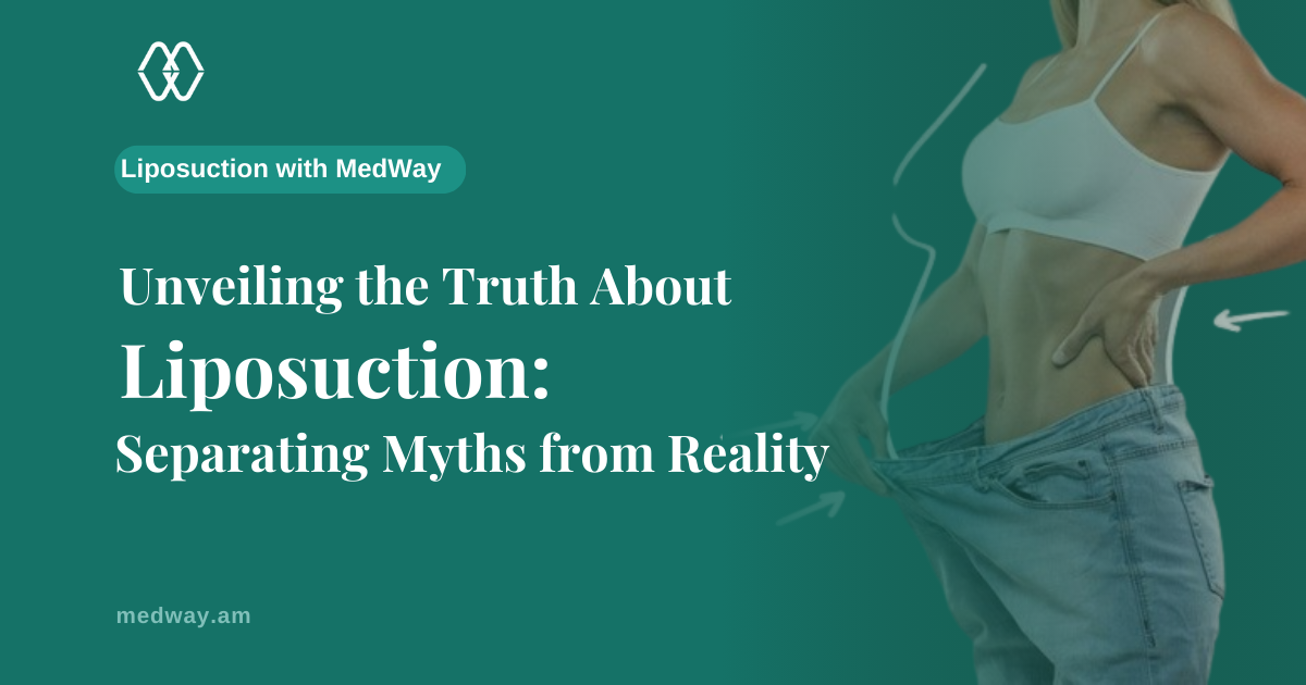Unveiling the Truth About Liposuction: Separating Myths from Reality